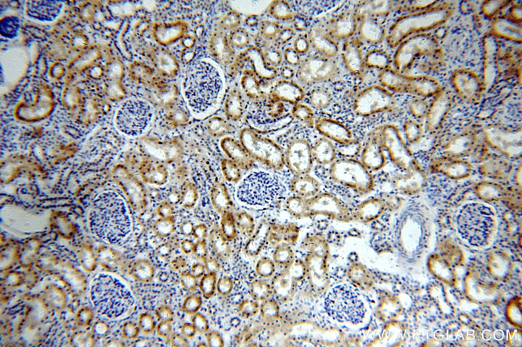 IHC staining of human kidney using 20421-1-AP