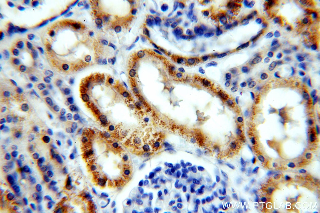 Immunohistochemistry (IHC) staining of human kidney tissue using PIGM Polyclonal antibody (20421-1-AP)