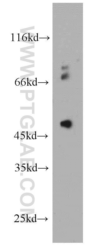 Western Blot (WB) analysis of HeLa cells using PIGM Polyclonal antibody (20421-1-AP)