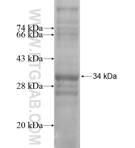 PIGM fusion protein Ag14245 SDS-PAGE