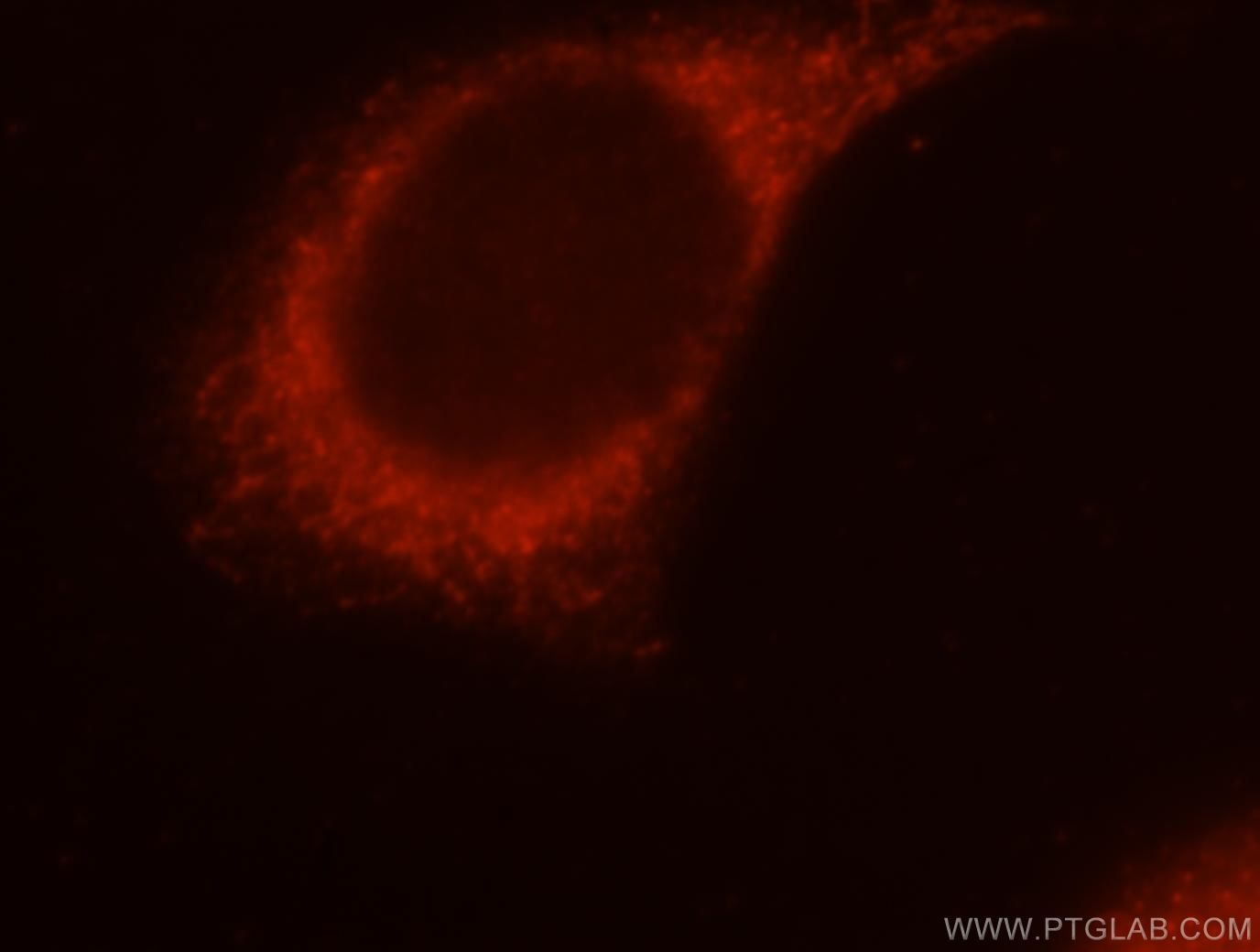 Immunofluorescence (IF) / fluorescent staining of MCF-7 cells using PIGO Polyclonal antibody (16369-1-AP)
