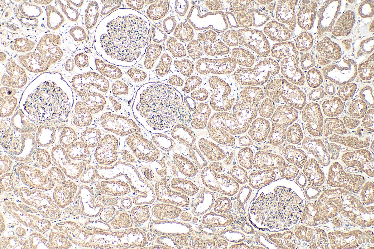 Immunohistochemistry (IHC) staining of human kidney tissue using PIGO Polyclonal antibody (16369-1-AP)