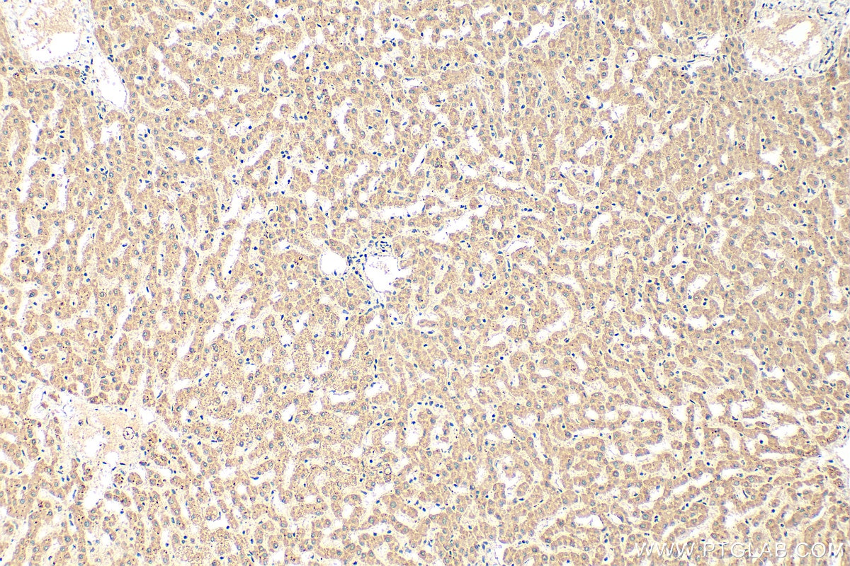Immunohistochemistry (IHC) staining of human liver tissue using PIGO Polyclonal antibody (16369-1-AP)