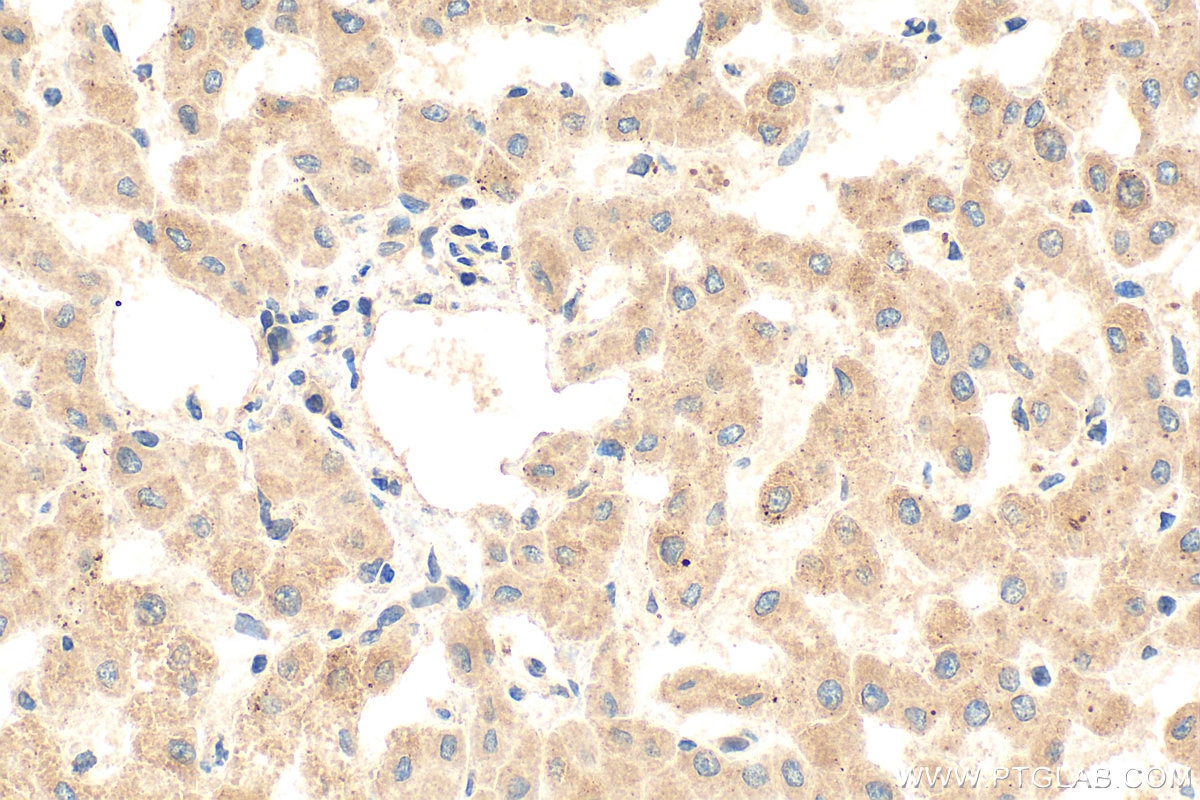 Immunohistochemistry (IHC) staining of human liver tissue using PIGO Polyclonal antibody (16369-1-AP)