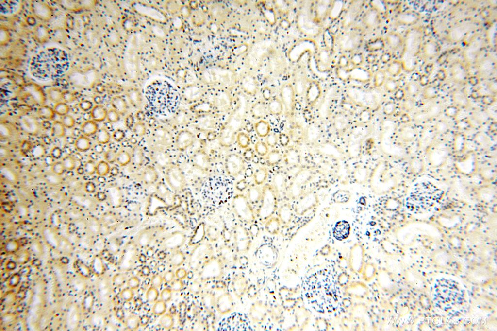 IHC staining of human kidney using 16369-1-AP