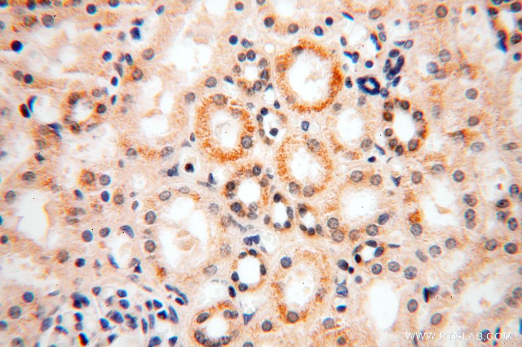 Immunohistochemistry (IHC) staining of human kidney tissue using PIGO Polyclonal antibody (16369-1-AP)