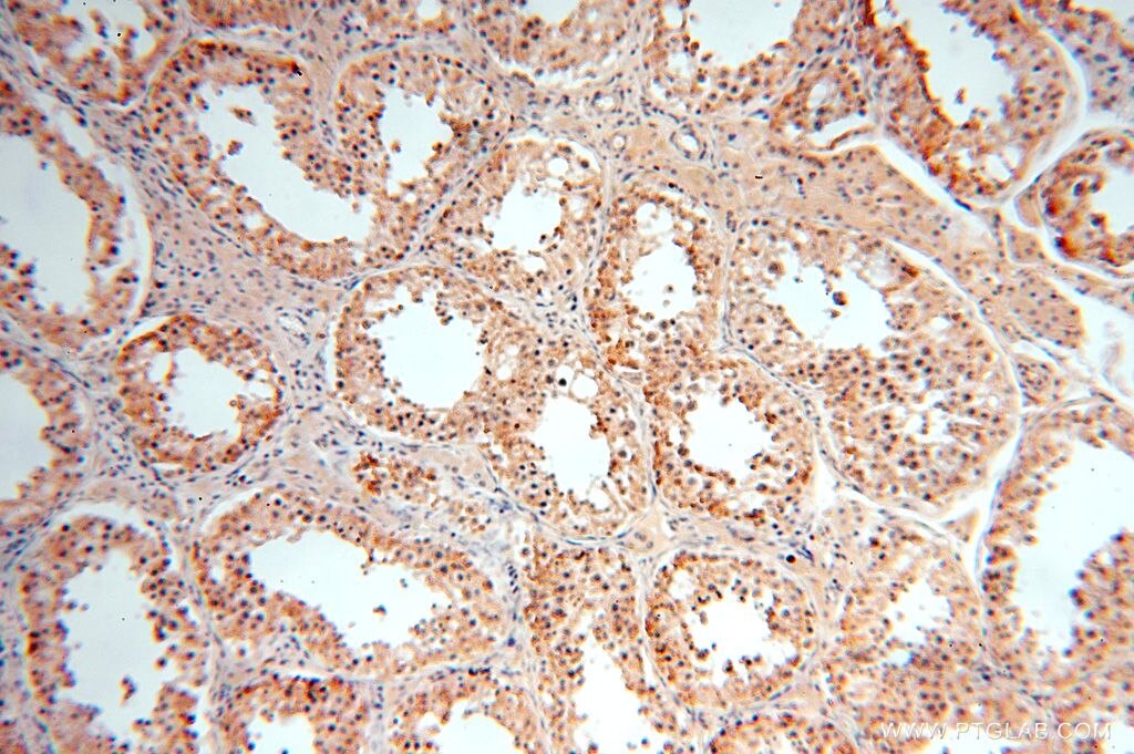 Immunohistochemistry (IHC) staining of human testis tissue using PIGO Polyclonal antibody (16369-1-AP)