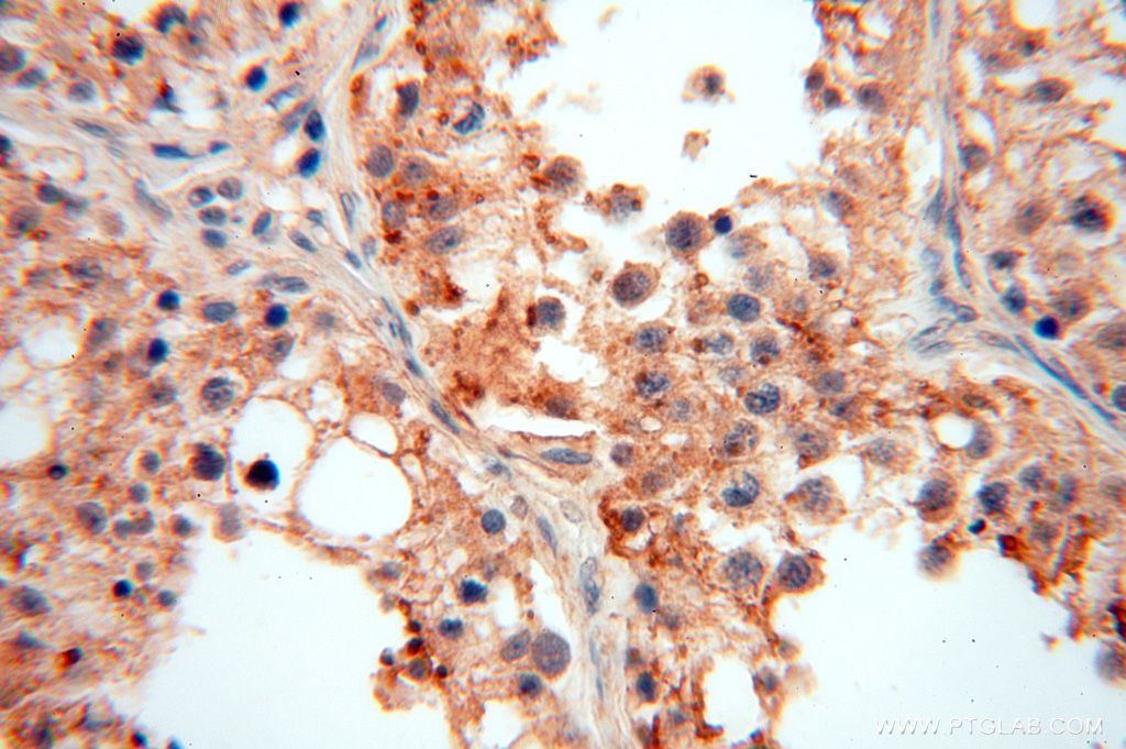 Immunohistochemistry (IHC) staining of human testis tissue using PIGO Polyclonal antibody (16369-1-AP)