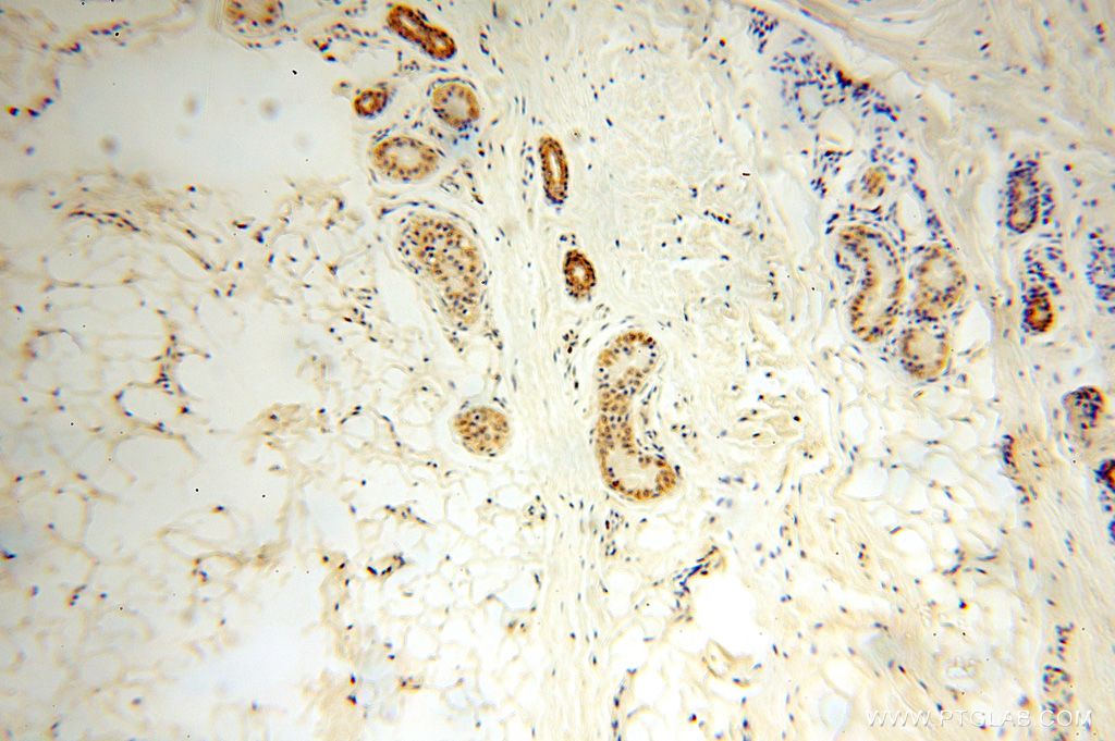 IHC staining of human skin using 16369-1-AP