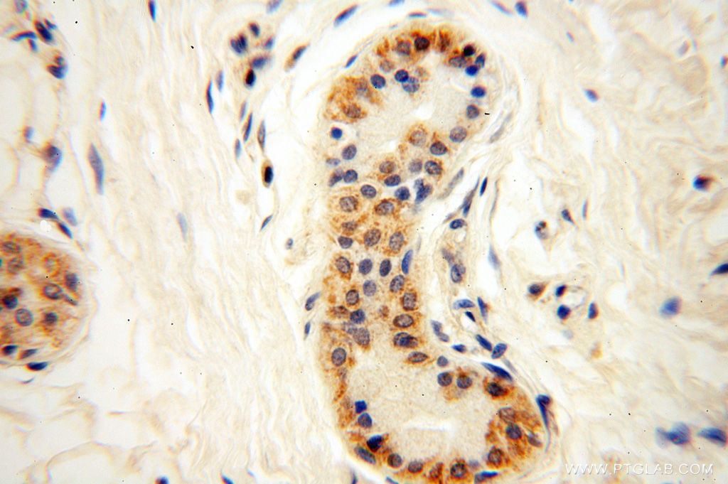 Immunohistochemistry (IHC) staining of human skin tissue using PIGO Polyclonal antibody (16369-1-AP)