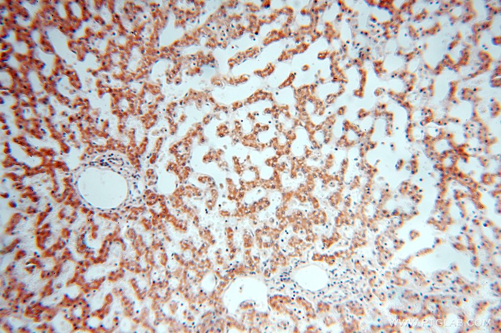 Immunohistochemistry (IHC) staining of human liver tissue using PIGO Polyclonal antibody (16369-1-AP)