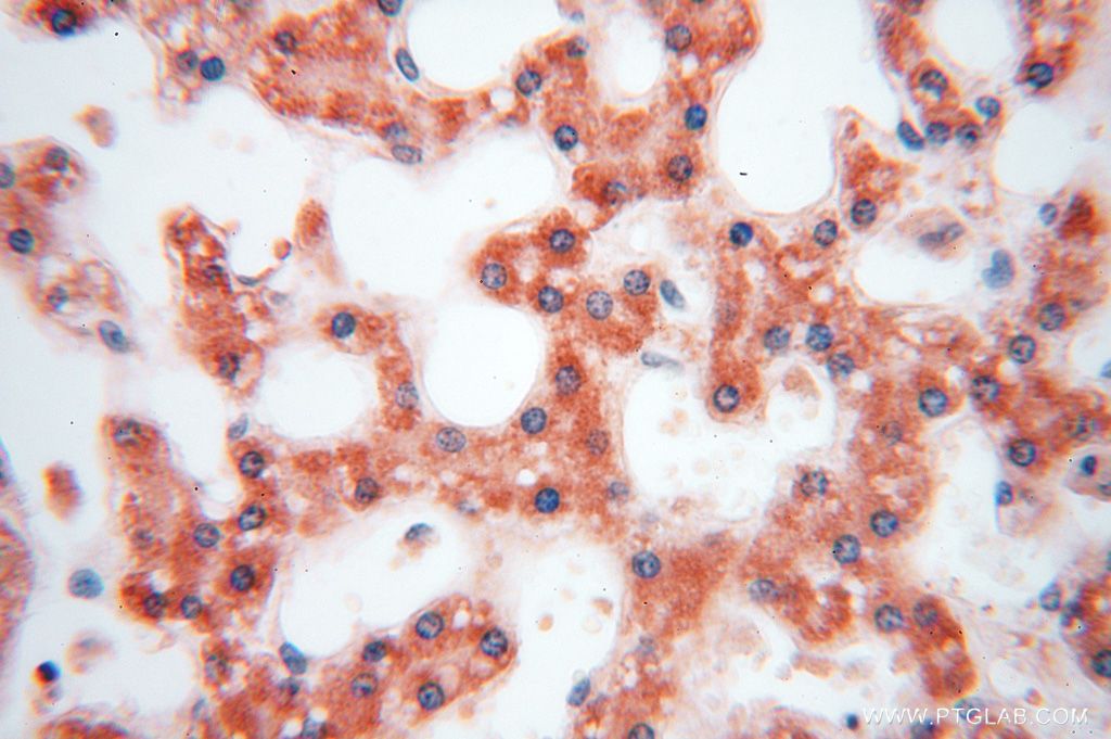 Immunohistochemistry (IHC) staining of human liver tissue using PIGO Polyclonal antibody (16369-1-AP)