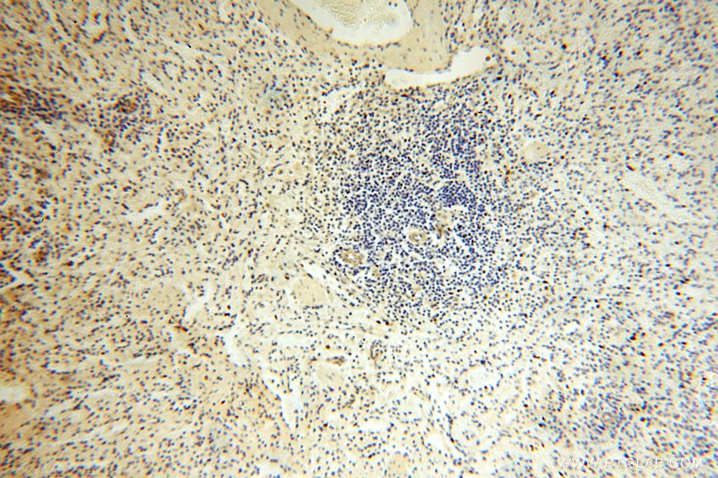 Immunohistochemistry (IHC) staining of human spleen tissue using PIGO Polyclonal antibody (16369-1-AP)