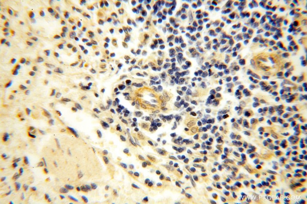 Immunohistochemistry (IHC) staining of human spleen tissue using PIGO Polyclonal antibody (16369-1-AP)