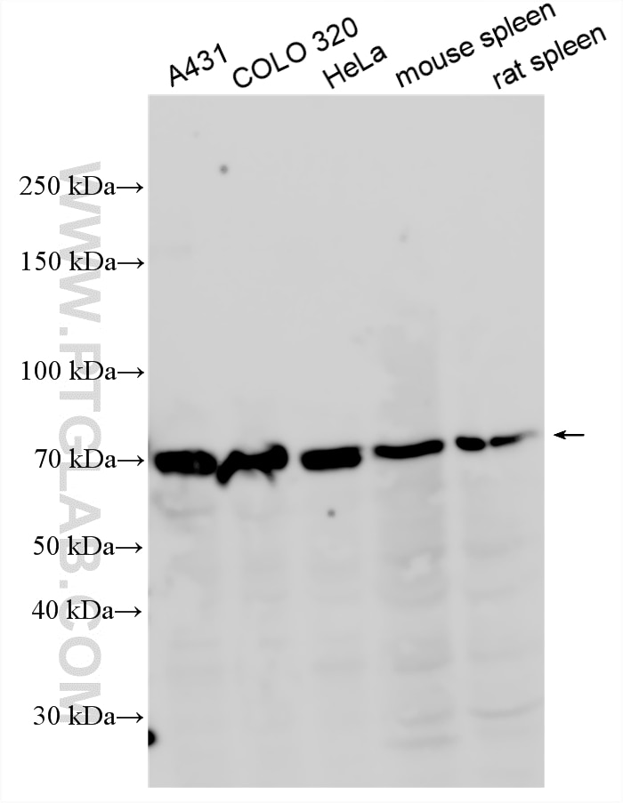 Western Blot (WB) analysis of various lysates using PIGO Polyclonal antibody (16369-1-AP)