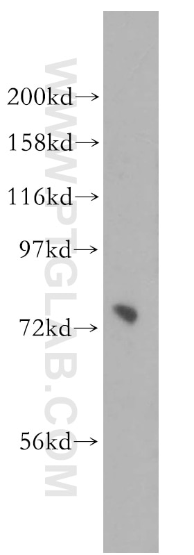 Western Blot (WB) analysis of HeLa cells using PIGO Polyclonal antibody (16369-1-AP)