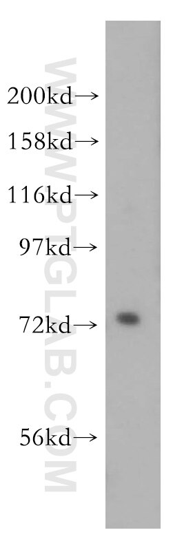 Western Blot (WB) analysis of COLO 320 cells using PIGO Polyclonal antibody (16369-1-AP)
