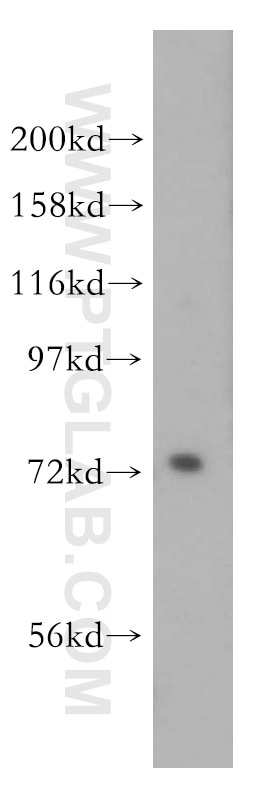 Western Blot (WB) analysis of COLO 320 cells using PIGO Polyclonal antibody (16369-1-AP)