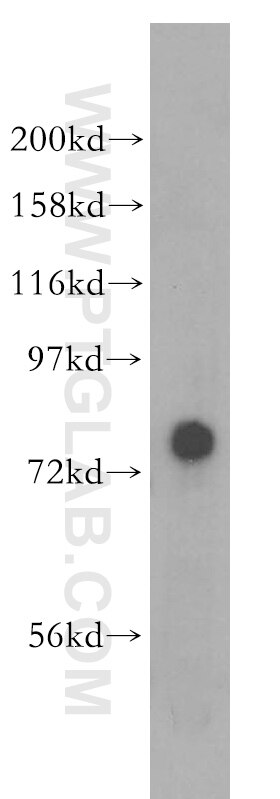 Western Blot (WB) analysis of A431 cells using PIGO Polyclonal antibody (16369-1-AP)