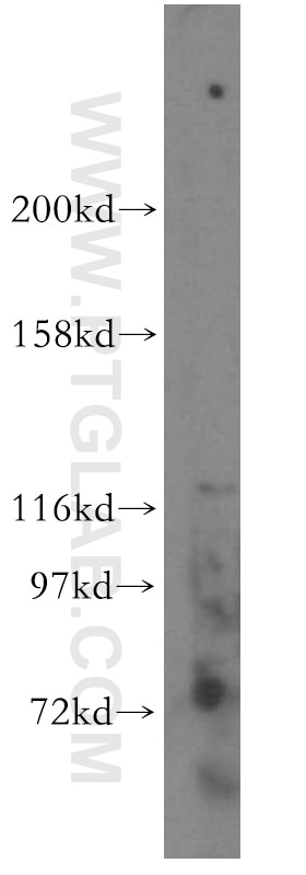 Western Blot (WB) analysis of mouse spleen tissue using PIGO Polyclonal antibody (16369-1-AP)
