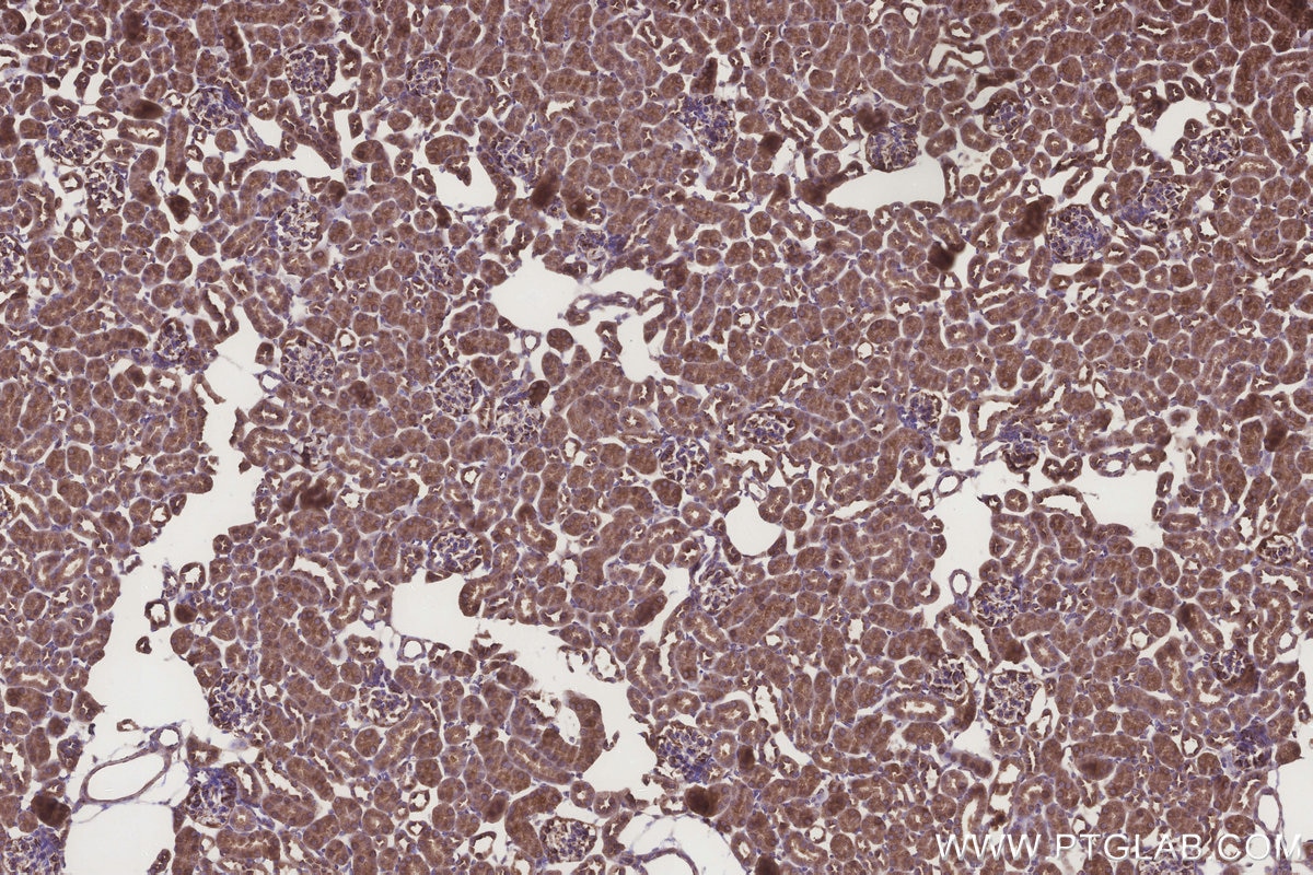 Immunohistochemistry (IHC) staining of mouse kidney tissue using PIGP Polyclonal antibody (30623-1-AP)