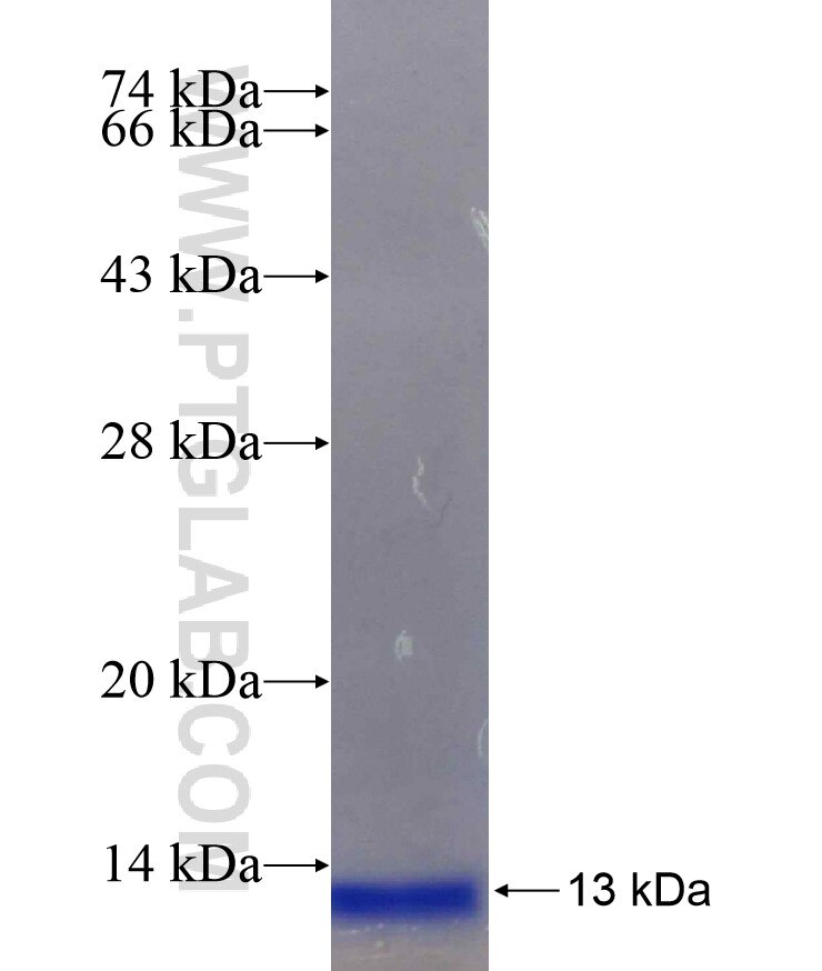 PIGP fusion protein Ag29498 SDS-PAGE