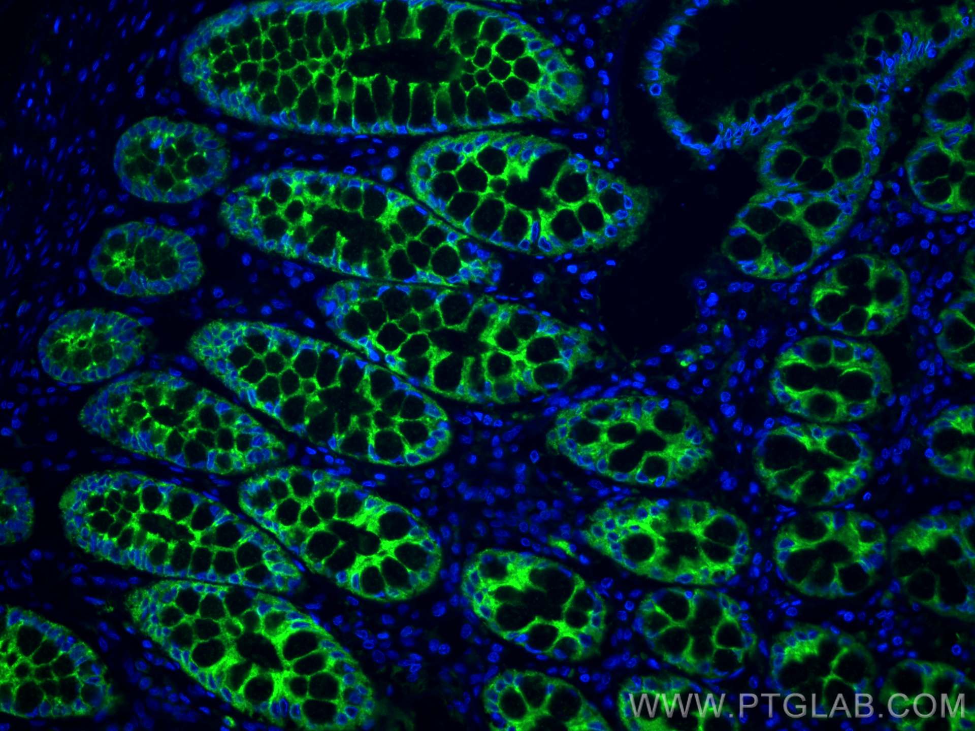 Immunofluorescence (IF) / fluorescent staining of human small intestine tissue using PIGR Polyclonal antibody (22024-1-AP)