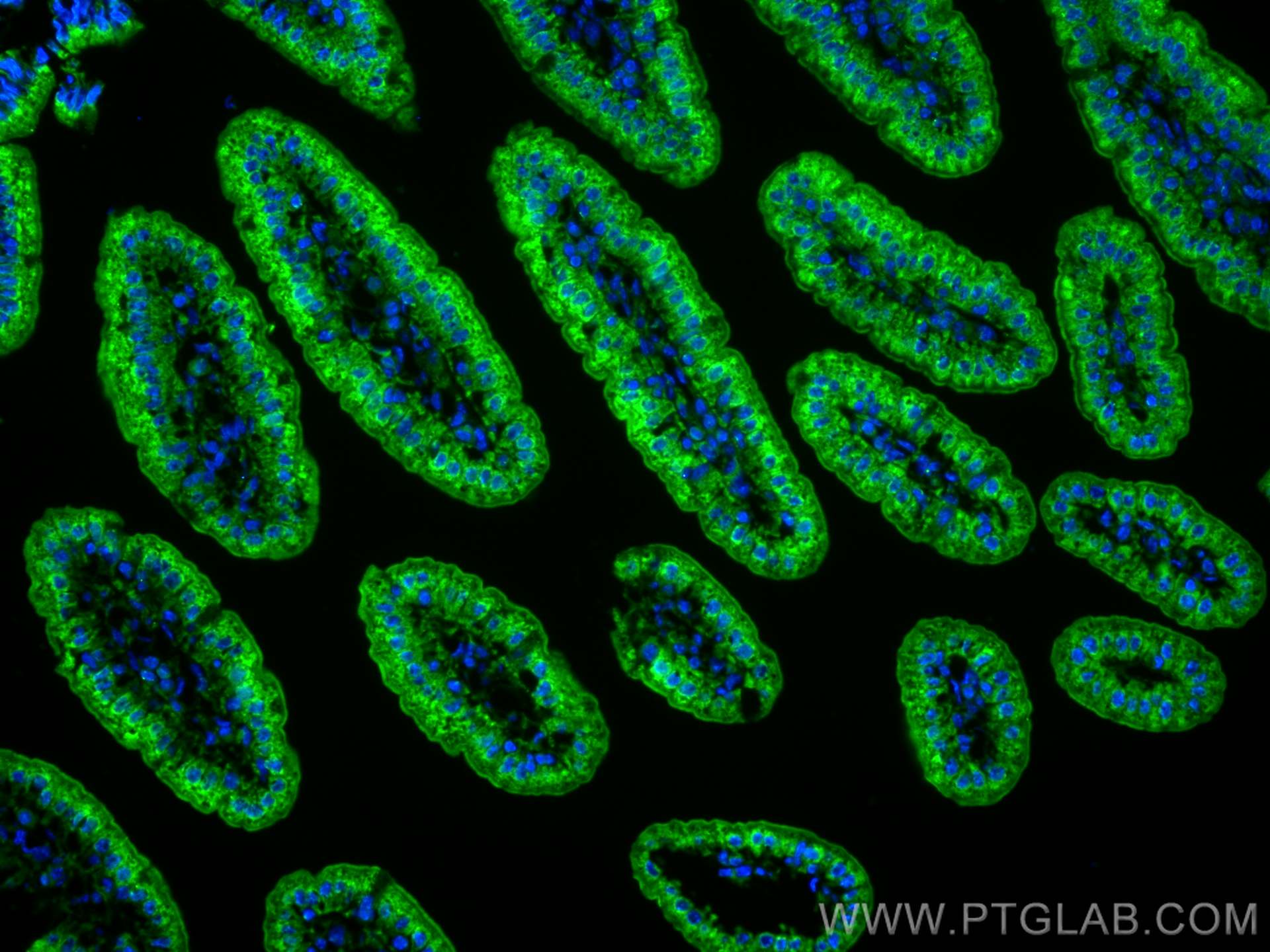 IF Staining of mouse small intestine using 22024-1-AP