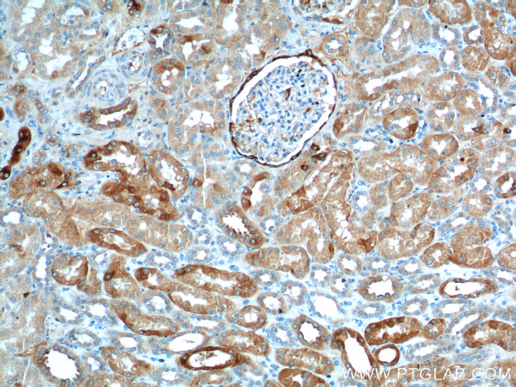 Immunohistochemistry (IHC) staining of human kidney tissue using PIGR Polyclonal antibody (22024-1-AP)