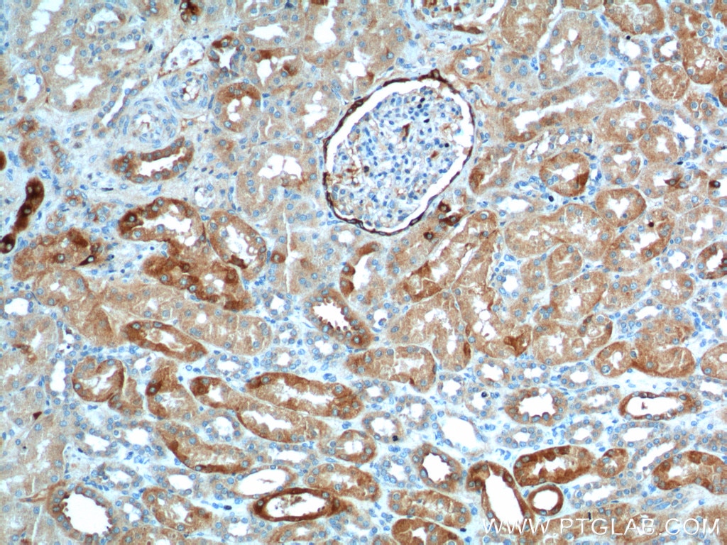 IHC staining of human kidney using 22024-1-AP