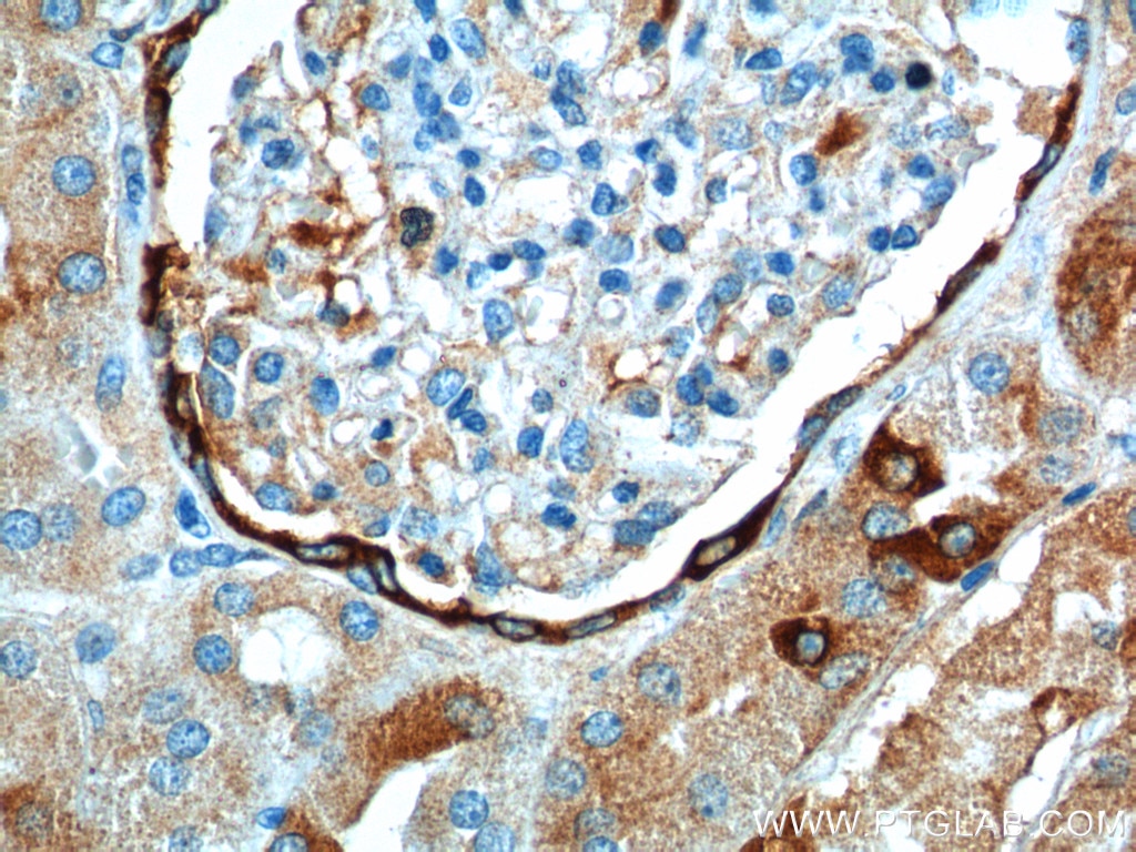 Immunohistochemistry (IHC) staining of human kidney tissue using PIGR Polyclonal antibody (22024-1-AP)