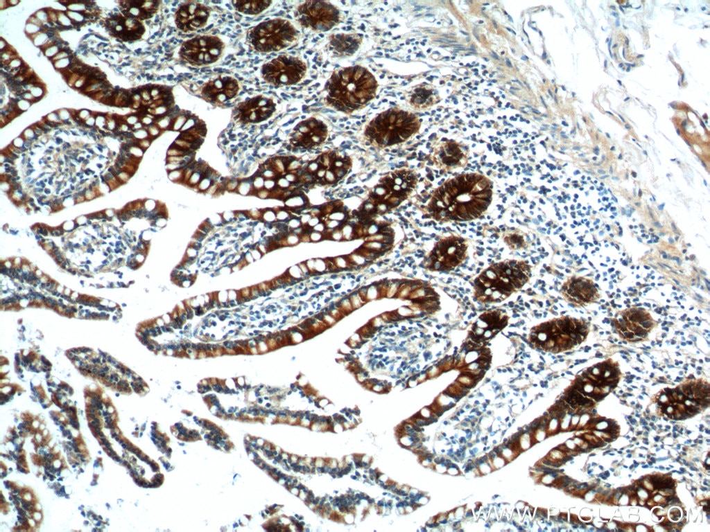 Immunohistochemistry (IHC) staining of human small intestine tissue using PIGR Polyclonal antibody (22024-1-AP)