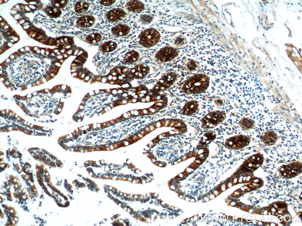 IHC staining of human small intestine using 22024-1-AP