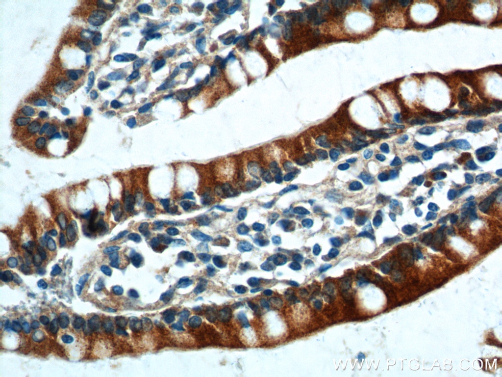 Immunohistochemistry (IHC) staining of human small intestine tissue using PIGR Polyclonal antibody (22024-1-AP)