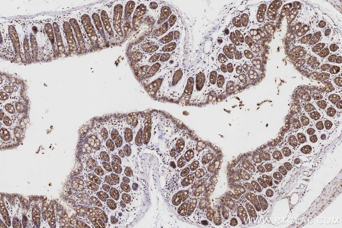 IHC staining of mouse colon using 22024-1-AP Immunohistochemistry (IHC) staining of mouse colon tissue using PIGR Polyclonal antibody (22024-1-AP)