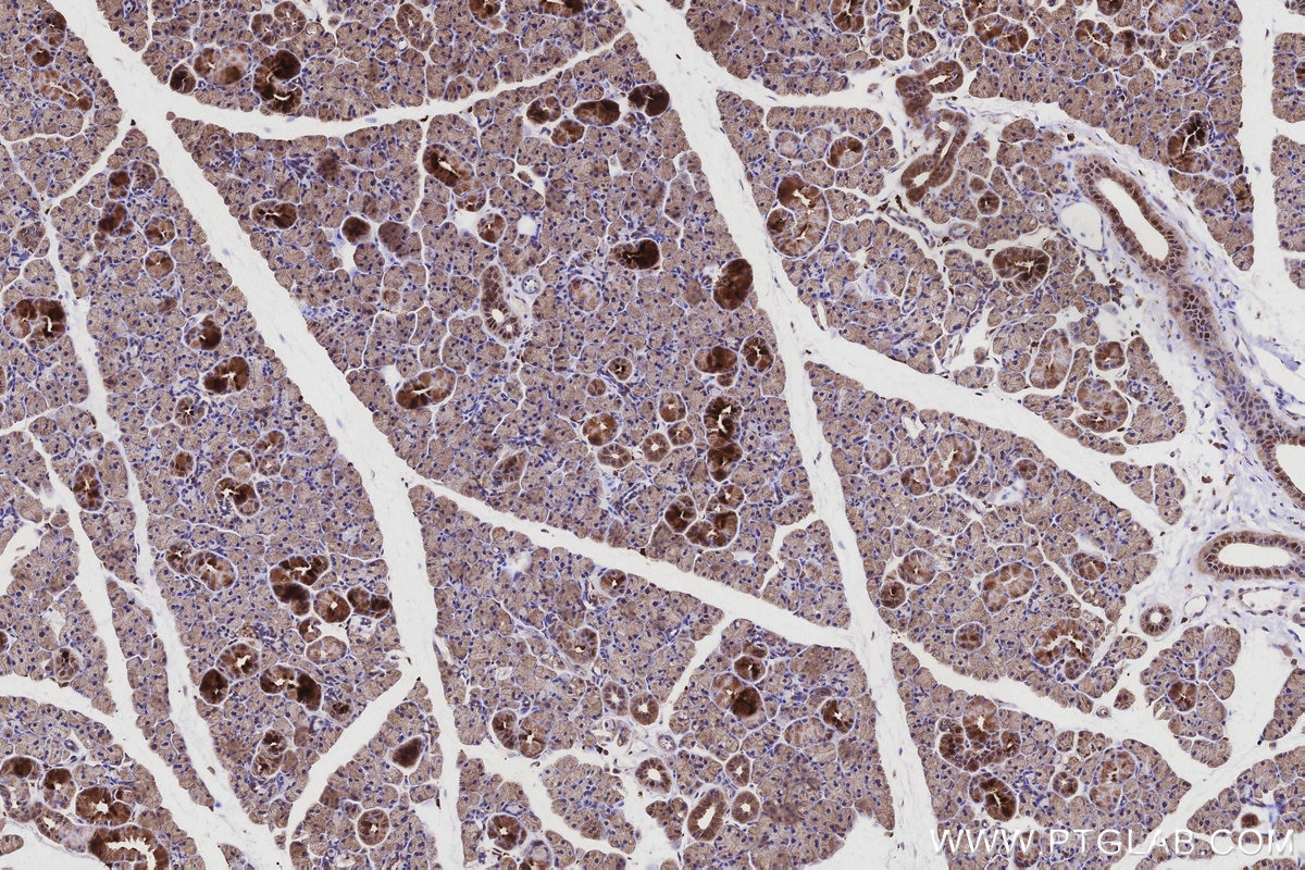 IHC staining of rat salivary gland using 22024-1-AP Immunohistochemistry (IHC) staining of rat salivary gland tissue using PIGR Polyclonal antibody (22024-1-AP)