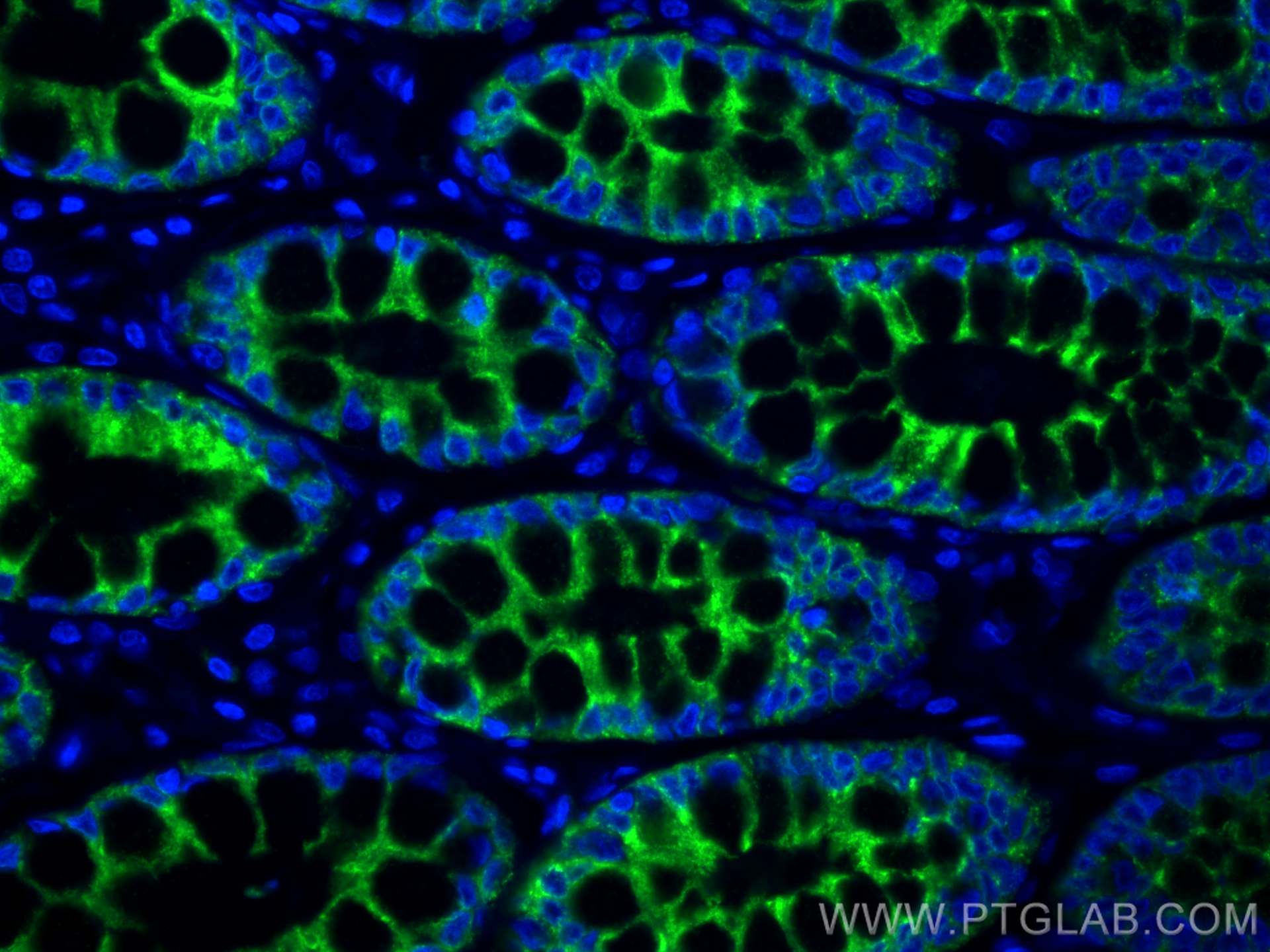 Immunofluorescence (IF) / fluorescent staining of human small intestine tissue using CoraLite® Plus 488-conjugated PIGR Polyclonal anti (CL488-22024)