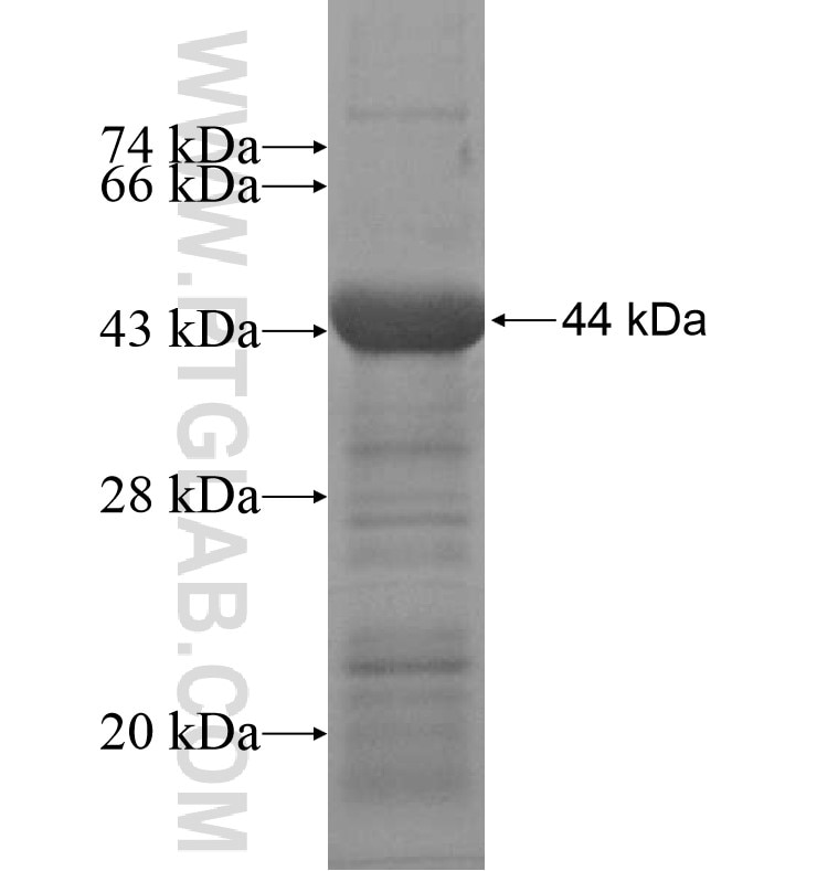 PIGR fusion protein Ag16876 SDS-PAGE