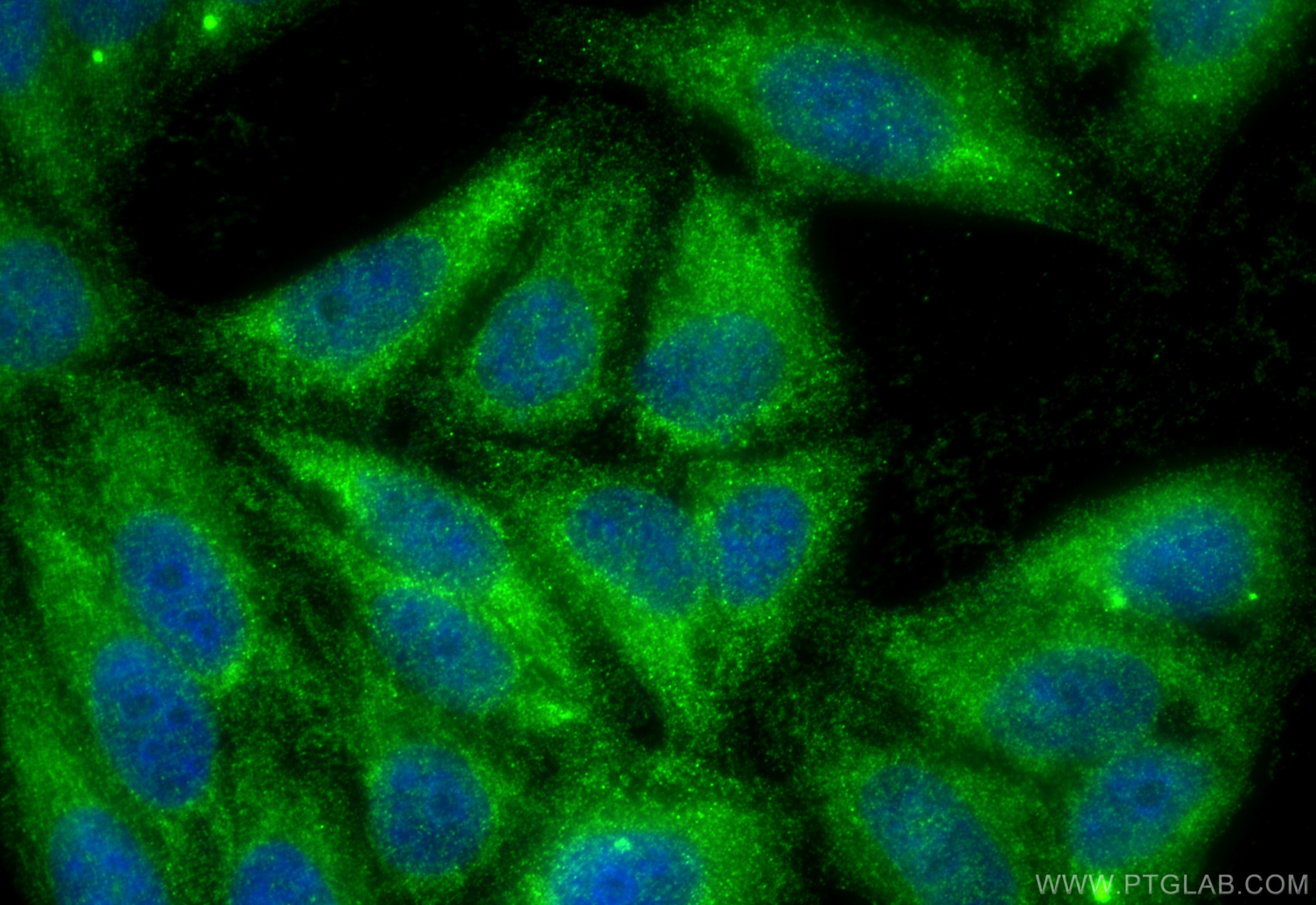 Immunofluorescence (IF) / fluorescent staining of HepG2 cells using PIGS Polyclonal antibody (18334-1-AP)