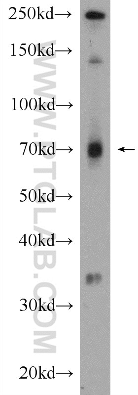Western Blot (WB) analysis of mouse liver tissue using PIGS Polyclonal antibody (18334-1-AP)