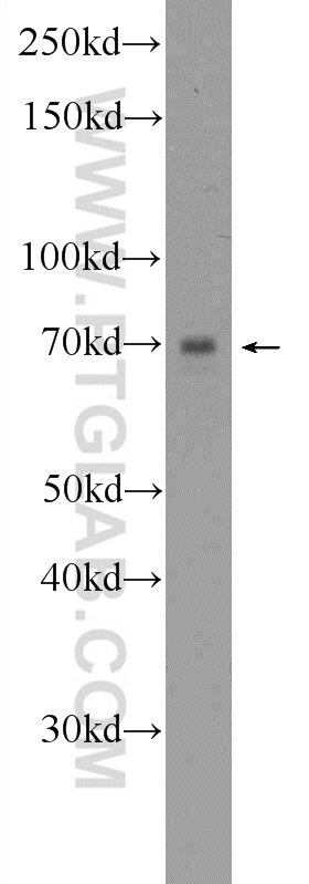 Western Blot (WB) analysis of HepG2 cells using PIGS Polyclonal antibody (18334-1-AP)