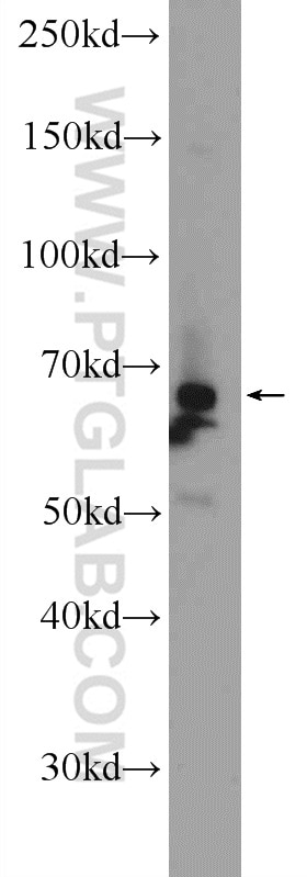 Western Blot (WB) analysis of A549 cells using PIGS Polyclonal antibody (18334-1-AP)