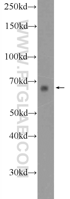 Western Blot (WB) analysis of PC-3 cells using PIGS Polyclonal antibody (18334-1-AP)