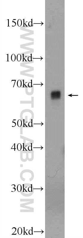 Western Blot (WB) analysis of HeLa cells using PIGS Polyclonal antibody (18334-1-AP)