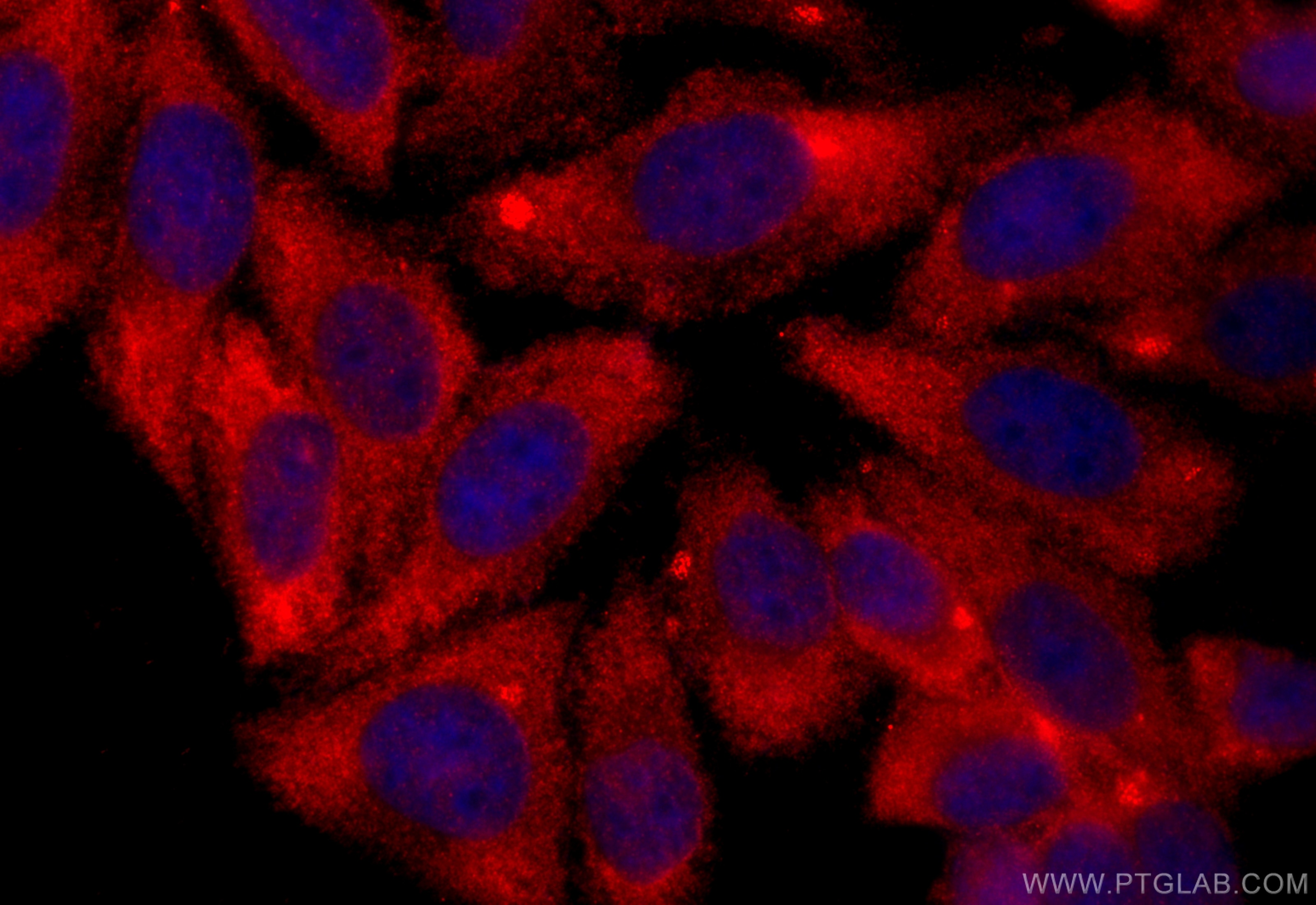 Immunofluorescence (IF) / fluorescent staining of HepG2 cells using PIGT Polyclonal antibody (16906-1-AP)