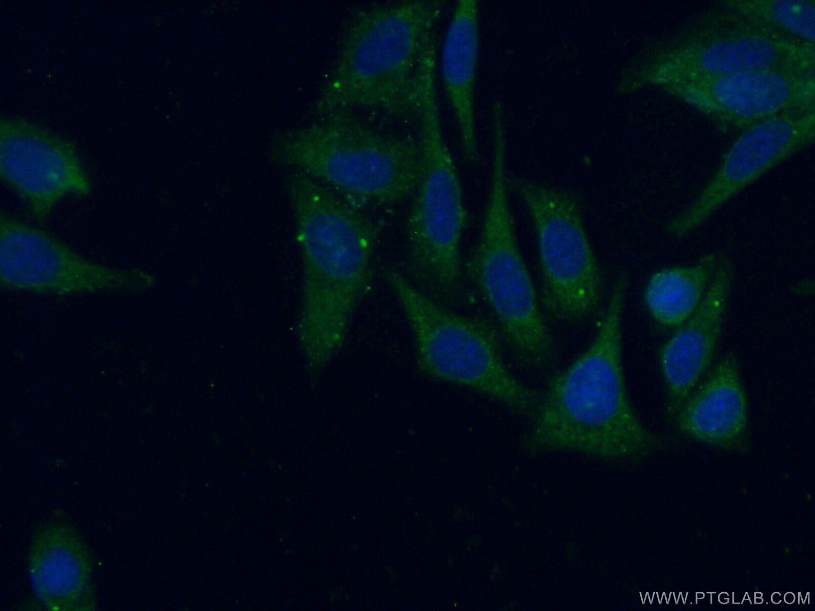 Immunofluorescence (IF) / fluorescent staining of HepG2 cells using PIGT Polyclonal antibody (16906-1-AP)