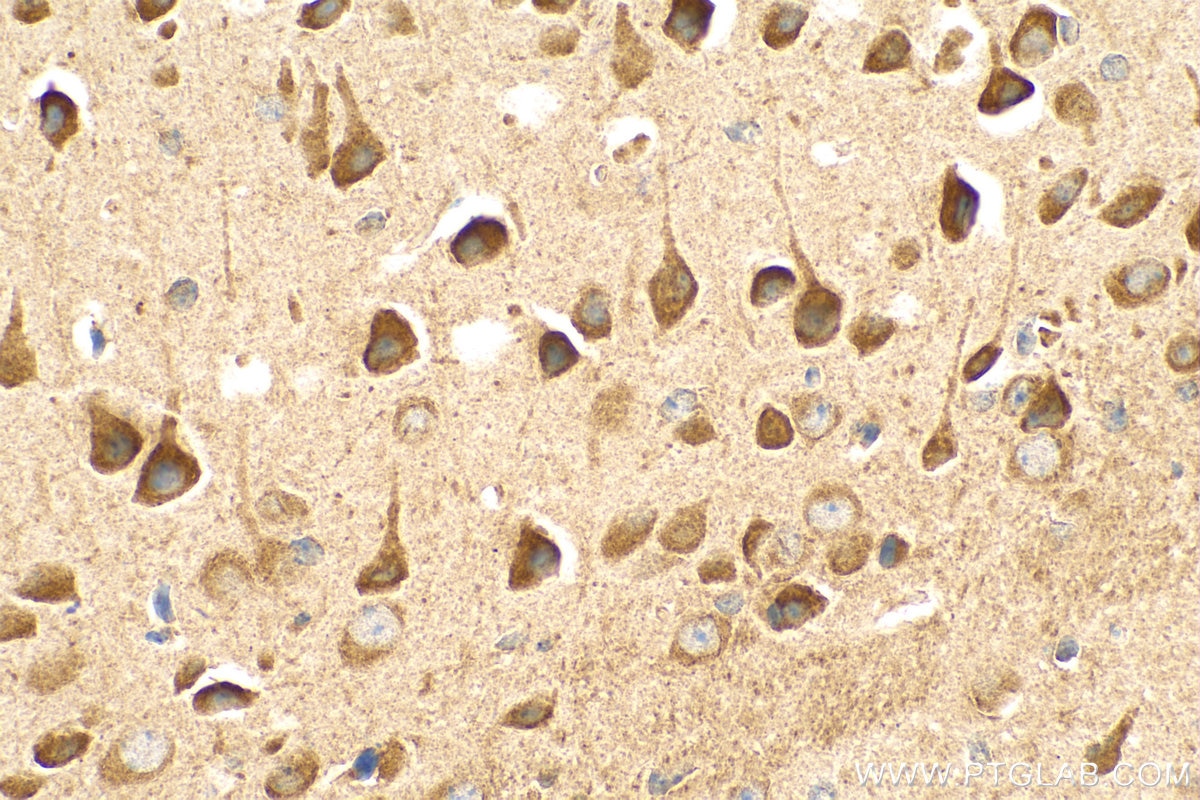 Immunohistochemistry (IHC) staining of mouse brain tissue using PIGT Polyclonal antibody (16906-1-AP)