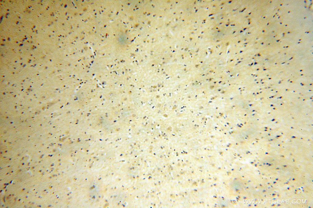 Immunohistochemistry (IHC) staining of human brain tissue using PIGT Polyclonal antibody (16906-1-AP)