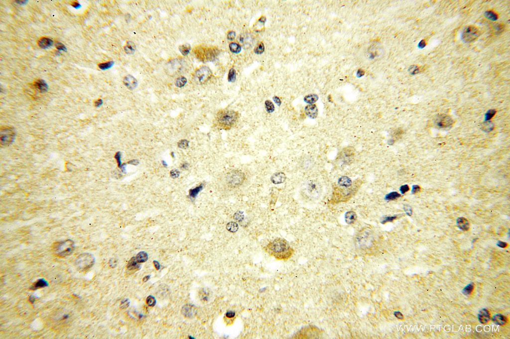 Immunohistochemistry (IHC) staining of human brain tissue using PIGT Polyclonal antibody (16906-1-AP)