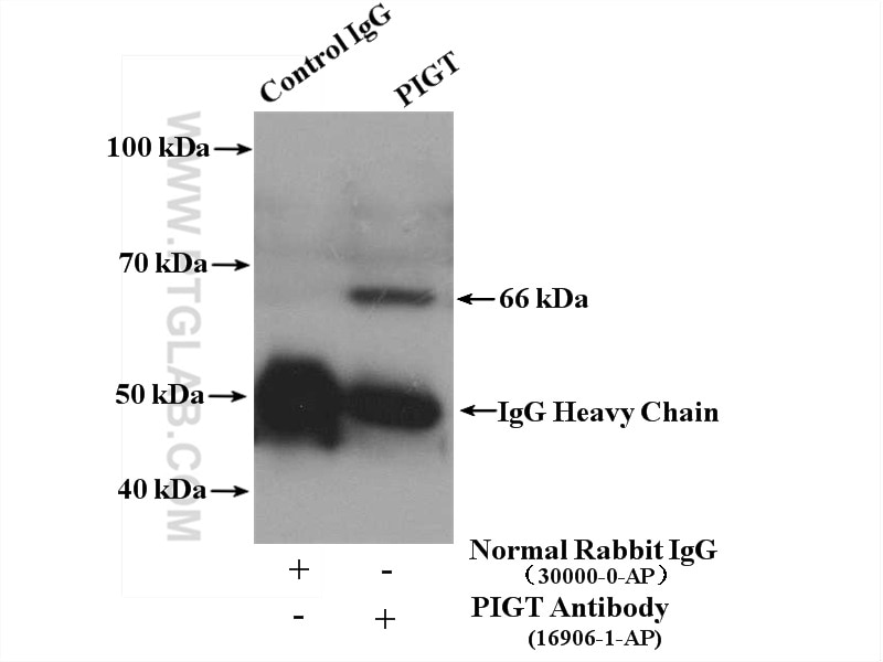 Immunoprecipitation (IP) experiment of mouse liver tissue using PIGT Polyclonal antibody (16906-1-AP)